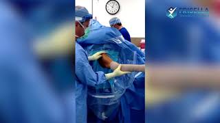 Frozen Shoulder Release Frisella Shoulder Surgery [upl. by Attayek]