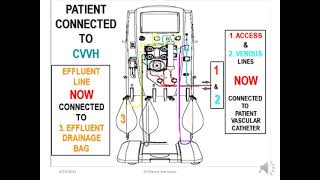 Dr Manny Learnshop CRRT Part 3 Overview the Primaflex therapy unit [upl. by Mears738]