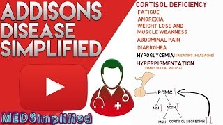 Addisons Disease Made Simple  Primary Adrenal Faliure [upl. by Connelly201]