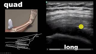 Introduction to Musculoskeletal Ultrasound [upl. by Nyrol890]