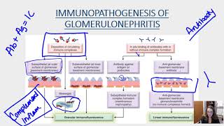 GLOMERULONEPHRITIS [upl. by Aivon]