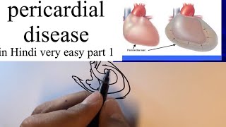 Pericardial disease pathology in hindi part 1 signsymptomsclinicaldiagnosis and treatment [upl. by Bocaj]