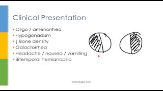 Learn OBGYN Hyperprolactinemia [upl. by Naraa]