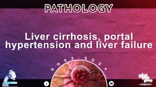 Revision of L6 Liver cirrhosis Portal hypertension and Liver failure Pathology [upl. by Sirrap]