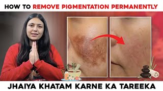 How to remove Pigmentation Permanently  Best Home Remedies  Skin Care Tips  Upasana Ki Duniya [upl. by Enamrahs]