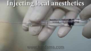 Spinal anesthesia [upl. by Betteanne490]