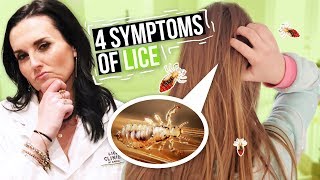 Head lice treatment safe and natural waykuto removalhome remedy remove head lice in a single day [upl. by Rahab]