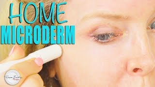 How to do Microdermabrasion at Home DIY [upl. by Akinit]