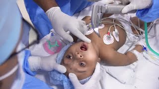 Crying Baby Going into Anesthesia [upl. by Bores]