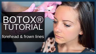 BOTOX® Injection  Forehead Wrinkles and Frown Lines  Atlanta Botox® [upl. by Lamoureux]