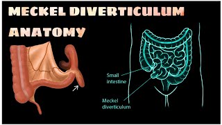 MECKEL DIVERTICULUM Anatomy brdmedicalcollege anatomy mbbs trending youtube top [upl. by Ynahirb]