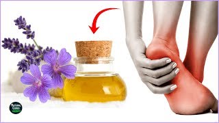 Treat Plantar Fasciitis Naturally  Instant Cure for Plantar Fasciitis [upl. by Sabian593]