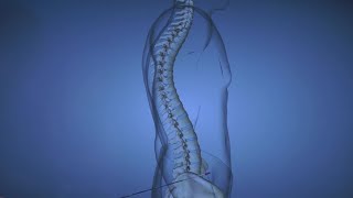 Spine Disease Kyphosis [upl. by Dolores]