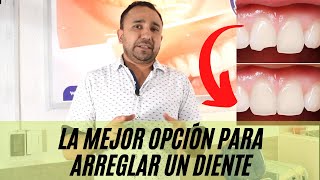 ¿Qué es mejor para dientes frontales CARILLAS ó RESINA [upl. by Ayoral]