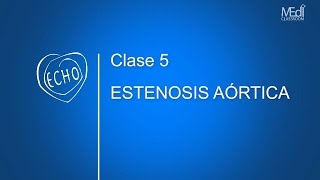 CLASE 5  Estenosis Aórtica [upl. by Enileqcaj735]