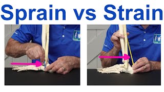 Sprain vs Strain Understanding the Key Differences [upl. by Tav925]