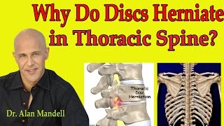 Severe Herniated Disc Patients 1st Time Adjustment From Your Houston Chiropractor Dr Johnson [upl. by Yelad]