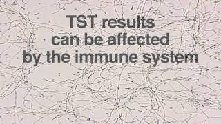 Diagnosis of Latent TB Infection LTBI [upl. by Aitekram]