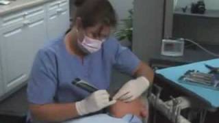 KaVo Diagnodent Pen Laser Fluorescence Caries Detection [upl. by Niltak538]