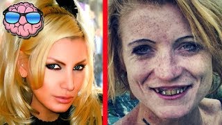 Top 10 Shocking Before And After Drug Use Photos [upl. by Zed264]