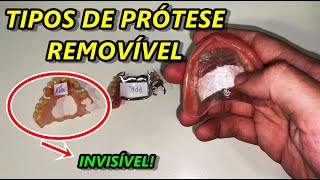 Explicando os principais tipos de prótese dentaria removível [upl. by Aihsikal]