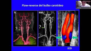 Ultrasound Week School  ECOSU101 lezione 19 [upl. by Dorothea33]