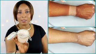 HOW TO REMOVE SUN TAN QUICKLY AND EFFECTIVELY FROM YOUR BODY Khichi Beauty [upl. by Koby]