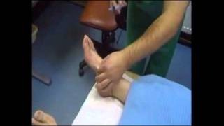 Foot Surgery Toe Straightening Procedure [upl. by Thedrick389]