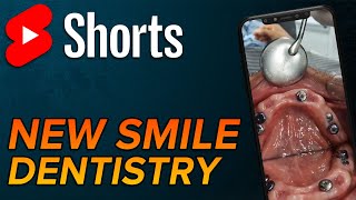 Smile transformation shorts [upl. by Melville]