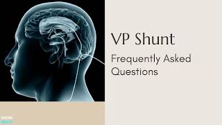 VP Shunt Frequently Asked Questions [upl. by Krystalle]