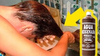 10 usos del Agua Oxigenada que DESCONOCÍAS [upl. by Sotnas]