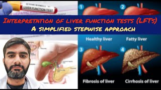 Interpretation of liver function tests LFTs [upl. by Ahtreb]