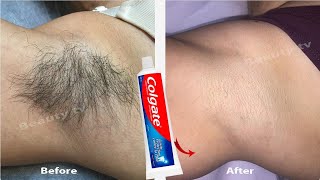 Stop Shaving it is the easiest way to remove facial body and public hair without pain [upl. by Adila291]