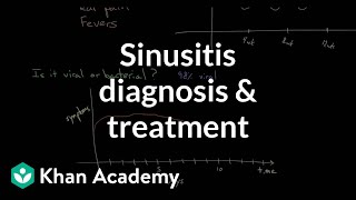 Sinusitis diagnosis and treatment  Respiratory system diseases  NCLEXRN  Khan Academy [upl. by Delila]