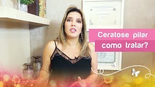 QUAL O TRATAMENTO INDICADO PARA CERATOSE PILAR ESSAS quotBOLINHASquot NOS BRAÇOS [upl. by Yleoj]