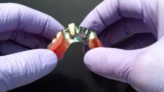 Soft Lining for Partial Dentures [upl. by Eidua]