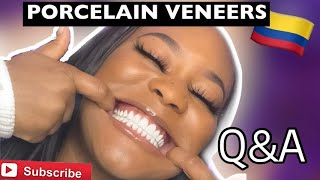 Porcelain Veneers QampA  DrGonzaga Tabares tips and tricks  What they dont tell you [upl. by Brom669]