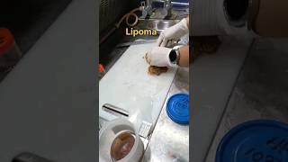 Lipoma tissue grossing  histopathology [upl. by Annoit]