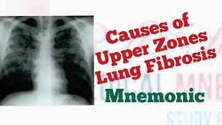 Upper Lobe Lung Fibrosis Causes Mnemonic by MedSurvival [upl. by Buffum612]