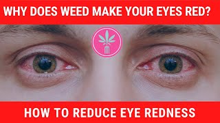 Why Does Marijuana Cause Red Eyes [upl. by Norted365]