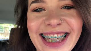 Adult braces VLOG I GOT POWERCHAINS [upl. by Ayat]