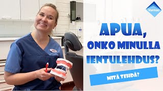 Mikä on ientulehdus [upl. by Hgiellek142]