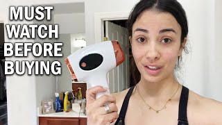 Aopvui IPL Hair Removal Laser Review  Is It REALLY Worth The Money Updated [upl. by Drofiar]