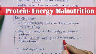 Protein  Energy Malnutrition  Kwashiorkor  Marasmus  Biochemistry [upl. by Enomrej740]