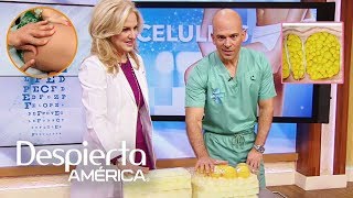 Celulitis por qué se produce y cómo evitarla  Dr Juan [upl. by Halivah]