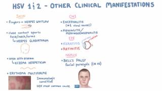 HSV  Clinical Presentation  Part 2 [upl. by Arerrac]