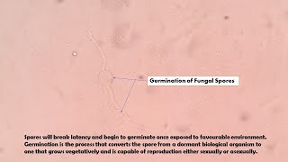 Germination of Fungal Spores Demonstration [upl. by Sikata917]