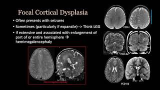 imaging Congenital malformation Brain and spine [upl. by Erfert]