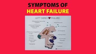 Symptoms of Heart Failure [upl. by Waldack]