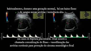 DOPPLER OBSTÉTRICA FETAL  ARTÉRIA CEREBRAL MÉDIA  CLÍNICA SARRAFF CURITIBA  PARTE 4 [upl. by Aleunamme]